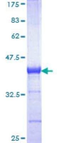 Novus Biologicals Recombinant Human CBS GST (N-Term) Protein 25 &mu;g | Buy Online | Novus Biologicals&trade; | Fisher Scientific