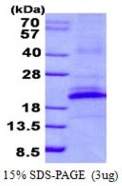 Novus Biologicals Recombinant Human CD161 His Protein 0.1 mg | Buy Online | Novus Biologicals&trade; | Fisher Scientific