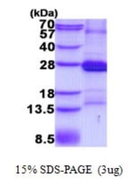Novus Biologicals&trade;&nbsp;Recombinant Human CD2 His Protein