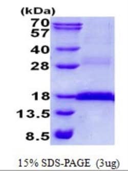 Novus Biologicals&trade;&nbsp;Recombinant Human CD3 epsilon His Protein