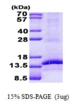 Novus Biologicals&trade;&nbsp;Recombinant Human CD3 gamma His Protein