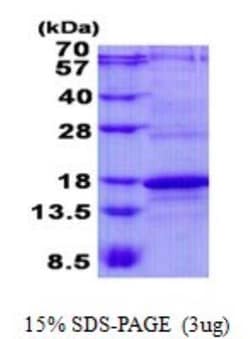 Novus Biologicals&trade;&nbsp;Recombinant Human CD3 zeta His Protein