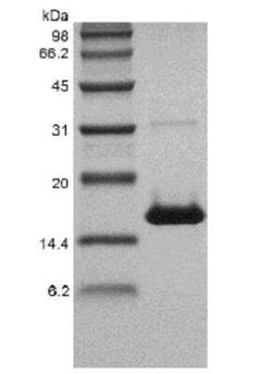 Novus Biologicals Recombinant Human CD40 Ligand/TNFSF5 Protein 1 mg | Buy Online | Novus Biologicals&trade; | Fisher Scientific