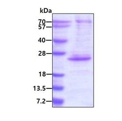 Novus Biologicals Recombinant Human CENPM His Protein 250 &mu;g | Buy Online | Novus Biologicals&trade; | Fisher Scientific