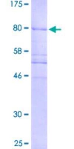 Novus Biologicals Recombinant Human CEP57 GST (N-Term) Protein 25 &mu;g | Buy Online | Novus Biologicals&trade; | Fisher Scientific