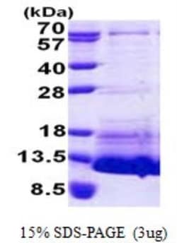 Novus Biologicals Recombinant Human CNP/NPPC His Protein 0.1 mg | Buy Online | Novus Biologicals&trade; | Fisher Scientific