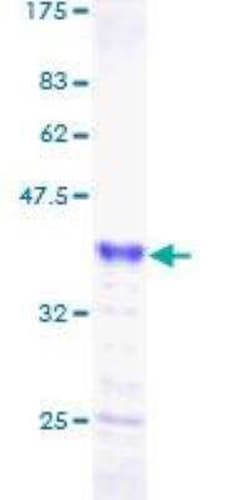 Novus Biologicals&trade;&nbsp;Recombinant Human COM1/p8 GST (N-Term) Protein