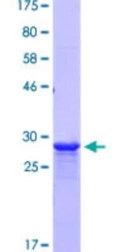 Novus Biologicals Recombinant Human CPNE5 GST (N-Term) Protein 25 &mu;g | Buy Online | Novus Biologicals&trade; | Fisher Scientific