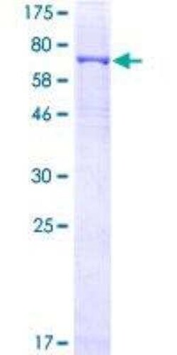 Novus Biologicals Recombinant Human CRBN GST (N-Term) Protein 10 &mu;g | Buy Online | Novus Biologicals&trade; | Fisher Scientific