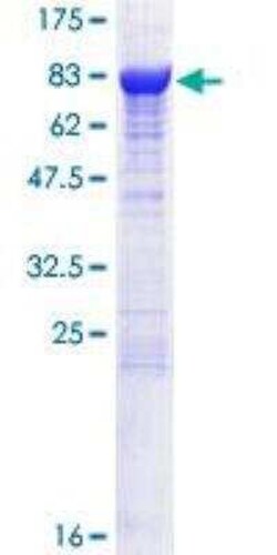 Novus Biologicals Recombinant Human CRMP2 GST (N-Term) Protein 25 &mu;g | Buy Online | Novus Biologicals&trade; | Fisher Scientific