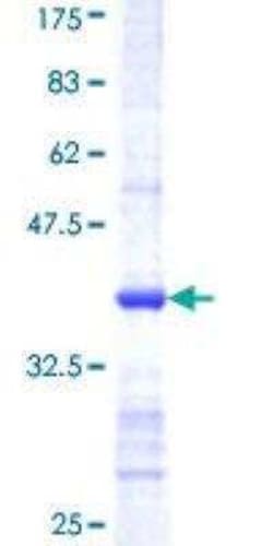 Novus Biologicals Recombinant Human CSAD GST (N-Term) Protein 10 &mu;g | Buy Online | Novus Biologicals&trade; | Fisher Scientific