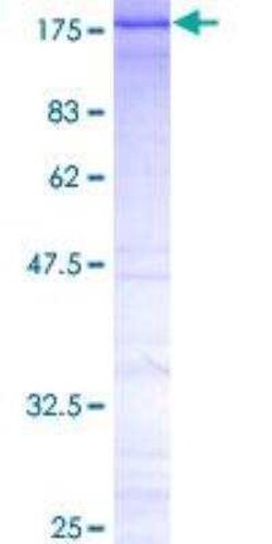 Novus Biologicals Recombinant Human CTCF GST (N-Term) Protein 2 &mu;g | Buy Online | Novus Biologicals&trade; | Fisher Scientific