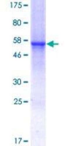 Novus Biologicals Recombinant Human CTRP7 GST (N-Term) Protein 10 &mu;g | Buy Online | Novus Biologicals&trade; | Fisher Scientific