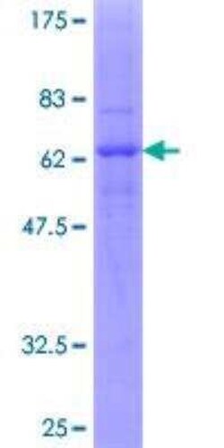 Novus Biologicals Recombinant Human CXCR2/IL-8RB GST (N-Term) Protein 25 &mu;g | Buy Online | Novus Biologicals&trade; | Fisher Scientific
