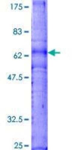 Novus Biologicals Recombinant Human CXCR3 GST (N-Term) Protein 2 &mu;g | Buy Online | Novus Biologicals&trade; | Fisher Scientific