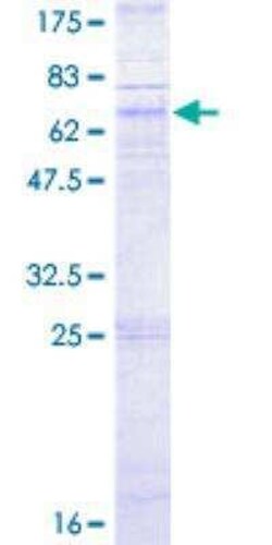Novus Biologicals Recombinant Human CXCR5 GST (N-Term) Protein 2 &mu;g | Buy Online | Novus Biologicals&trade; | Fisher Scientific