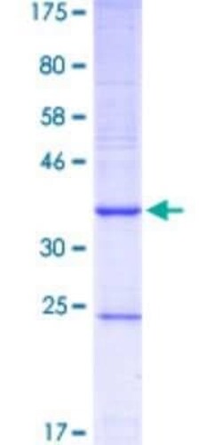 Novus Biologicals Recombinant Human CYP1B1 GST (N-Term) Protein 10 &mu;g | Buy Online | Novus Biologicals&trade; | Fisher Scientific