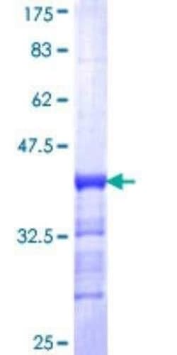 Novus Biologicals Recombinant Human CaM Kinase II alpha GST (N-Term) Protein 25 &mu;g | Buy Online | Novus Biologicals&trade; | Fisher Scientific