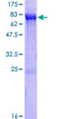 Novus Biologicals Recombinant Human CaM Kinase II delta GST (N-Term) Protein 25 &mu;g | Buy Online | Novus Biologicals&trade; | Fisher Scientific