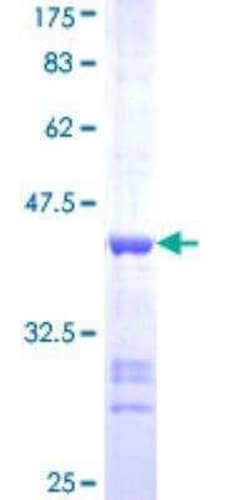 Novus Biologicals Recombinant Human CaM Kinase II delta GST (N-Term) Protein 25 &mu;g | Buy Online | Novus Biologicals&trade; | Fisher Scientific