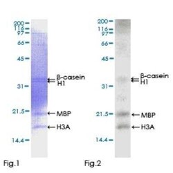 Novus Biologicals Recombinant Human CaM Kinase II gamma GST (N-Term) Protein 2 &mu;g | Buy Online | Novus Biologicals&trade; | Fisher Scientific