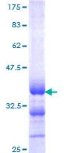 Novus Biologicals Recombinant Human Calcitonin GST (N-Term) Protein 10 &mu;g | Buy Online | Novus Biologicals&trade; | Fisher Scientific