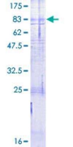 Novus Biologicals Recombinant Human Calcitonin R GST (N-Term) Protein 2 &mu;g | Buy Online | Novus Biologicals&trade; | Fisher Scientific