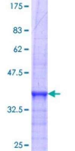 Novus Biologicals Recombinant Human Calcitonin R GST (N-Term) Protein 10 &mu;g | Buy Online | Novus Biologicals&trade; | Fisher Scientific