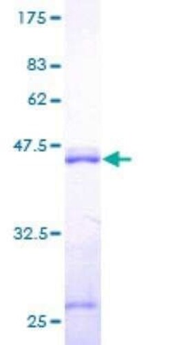 Novus Biologicals Recombinant Human Calmodulin 2 GST (N-Term) Protein 25 &mu;g | Buy Online | Novus Biologicals&trade; | Fisher Scientific