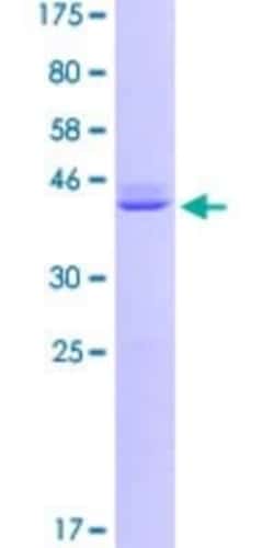 Novus Biologicals Recombinant Human Calmodulin 2 GST (N-Term) Protein 10 &mu;g | Buy Online | Novus Biologicals&trade; | Fisher Scientific
