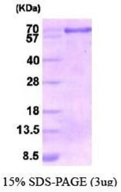 Novus Biologicals Recombinant Human Calnexin Protein 0.1mg | Buy Online | Novus Biologicals&trade; | Fisher Scientific