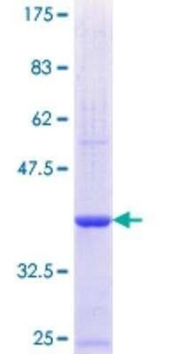Novus Biologicals Recombinant Human Calpain 3 GST (N-Term) Protein 25 &mu;g | Buy Online | Novus Biologicals&trade; | Fisher Scientific