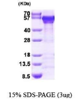 Novus Biologicals&trade;&nbsp;Recombinant Human Calreticulin His Protein