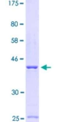 Novus Biologicals Recombinant Human Calsequestrin 1 GST (N-Term) Protein 10 &mu;g | Buy Online | Novus Biologicals&trade; | Fisher Scientific