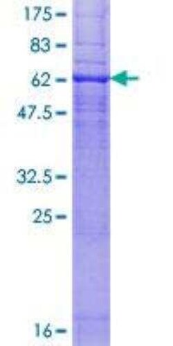 Novus Biologicals Recombinant Human Cannabinoid R2/CB2/CNR2 GST (N-Term) Protein 2µg | Buy Online | Novus Biologicals | Fisher Scientific