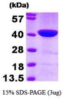 Novus Biologicals&trade;&nbsp;Recombinant Human CapG Protein
