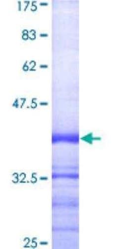 Novus Biologicals Recombinant Human Caspase-1 GST (N-Term) Protein 25 &mu;g | Buy Online | Novus Biologicals&trade; | Fisher Scientific
