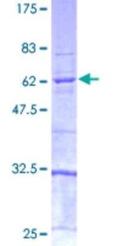 Novus Biologicals Recombinant Human Caspase-4 GST (N-Term) Protein 25 &mu;g | Buy Online | Novus Biologicals&trade; | Fisher Scientific