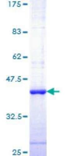 Novus Biologicals Recombinant Human Caspase-6 GST (N-Term) Protein 10 &mu;g | Buy Online | Novus Biologicals&trade; | Fisher Scientific
