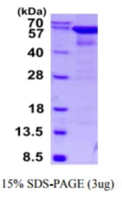 Novus Biologicals Recombinant Human Catalase Protein 0.5 mg | Buy Online | Novus Biologicals&trade; | Fisher Scientific