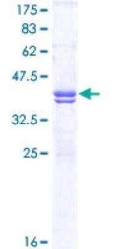Novus Biologicals Recombinant Human Cav1.2 GST (N-Term) Protein 10 &mu;g | Buy Online | Novus Biologicals&trade; | Fisher Scientific