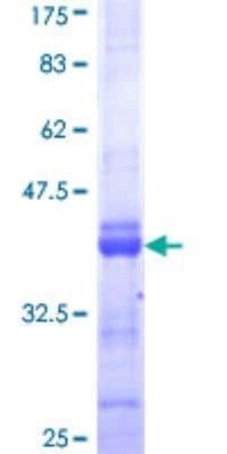 Novus Biologicals Recombinant Human Cav1.4 GST (N-Term) Protein 25 &mu;g | Buy Online | Novus Biologicals&trade; | Fisher Scientific