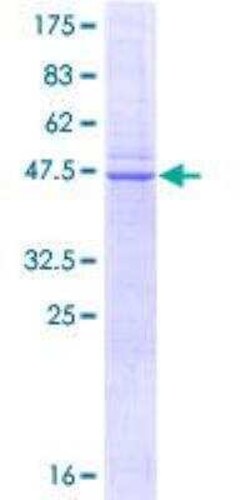 Novus Biologicals Recombinant Human Caveolin-1 GST (N-Term) Protein 25 &mu;g | Buy Online | Novus Biologicals&trade; | Fisher Scientific