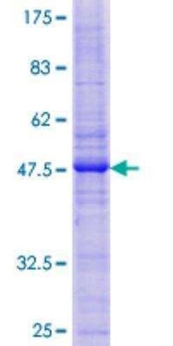 Novus Biologicals Recombinant Human Caveolin-2 GST (N-Term) Protein 10 &mu;g | Buy Online | Novus Biologicals&trade; | Fisher Scientific