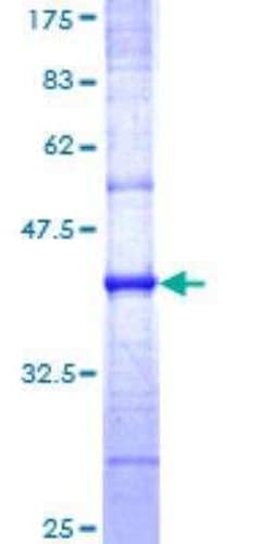 Novus Biologicals Recombinant Human Caveolin-3 GST (N-Term) Protein 25 &mu;g | Buy Online | Novus Biologicals&trade; | Fisher Scientific