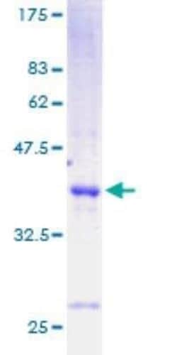 Novus Biologicals Recombinant Human Cholecystokinin GST (N-Term) Protein 25 &mu;g | Buy Online | Novus Biologicals&trade; | Fisher Scientific