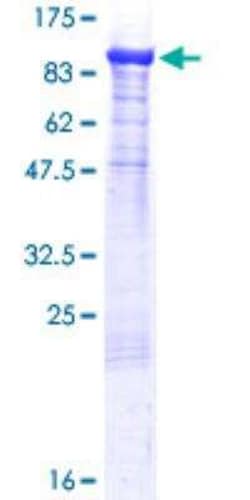 Novus Biologicals Recombinant Human Chromogranin C GST (N-Term) Protein 10 &mu;g | Buy Online | Novus Biologicals&trade; | Fisher Scientific