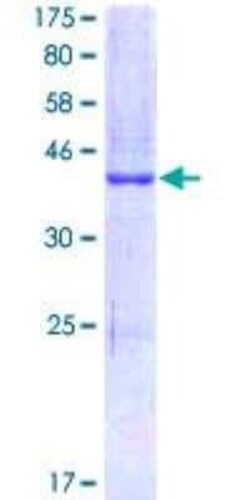 Novus Biologicals Recombinant Human Claudin-1 GST (N-Term) Protein 2 &mu;g | Buy Online | Novus Biologicals&trade; | Fisher Scientific