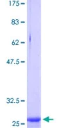 Novus Biologicals Recombinant Human Claudin-2 GST (N-Term) Protein 25 &mu;g | Buy Online | Novus Biologicals&trade; | Fisher Scientific
