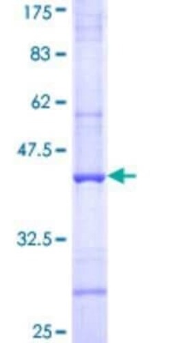 Novus Biologicals Recombinant Human Complement C4b GST (N-Term) Protein 10 &mu;g | Buy Online | Novus Biologicals&trade; | Fisher Scientific